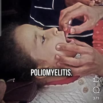 Polio and measles misinformation