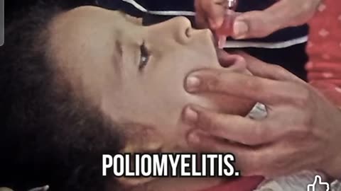 Polio and measles misinformation