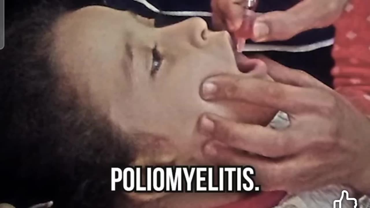 Polio and measles misinformation