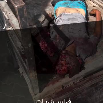 Arrival of a martyr who targeted a group of citizens at Al-Babidi intersection (Graphic)