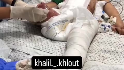 With her small, fragile body, she tried to survive after being left alone