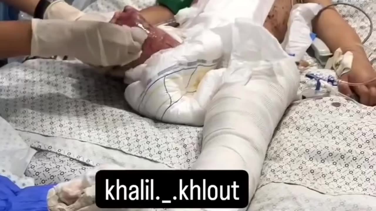 With her small, fragile body, she tried to survive after being left alone