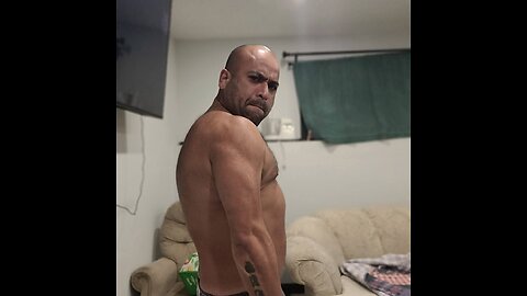 Part 2 of 2 of 7 December 19 2025 Hemophilia is a genetic bleeding disorder that prevents blood