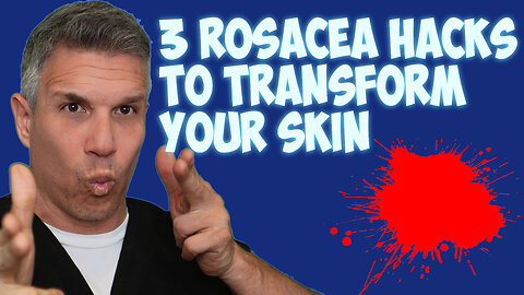 3 Rosacea Hacks to Transform Your Skin