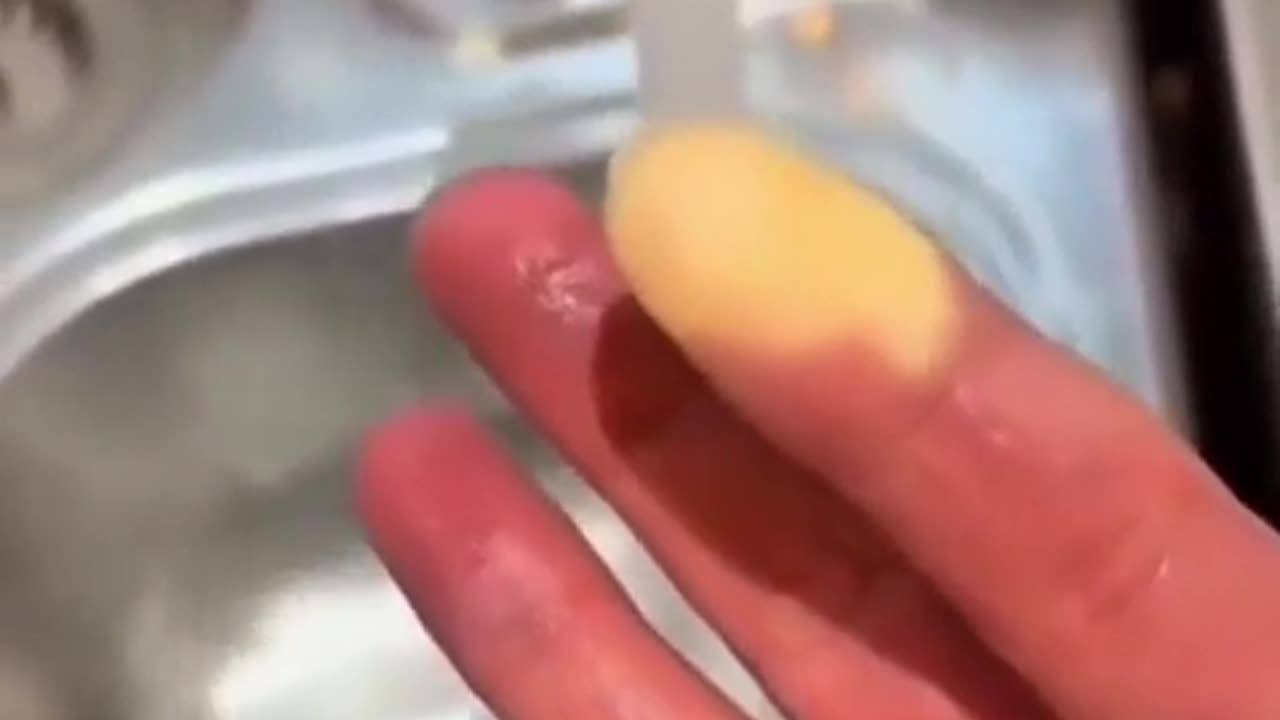 🤯✨ Discover How Hot Water Relieves Raynaud's Fingers! | FeedMyCuriosity