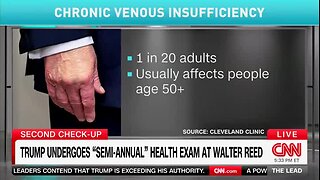Dr. Sanjay Gupta on Trump Dementia Screening Test: His Doctors Say That He‘s Gotten a Perfect Score