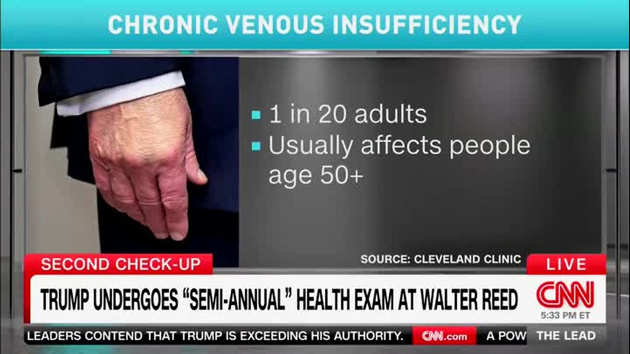 Dr. Sanjay Gupta on Trump Dementia Screening Test: His Doctors Say That He‘s Gotten a Perfect Score