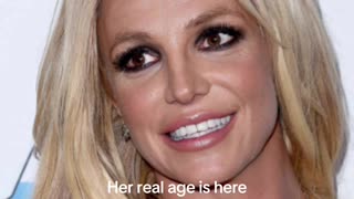 Brittney’s teeth! 🦷 👀👁️