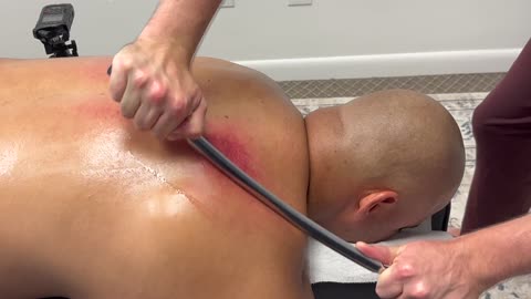 MOST SATISFYING TREATMENT ASMR SOUNDS FOR BED