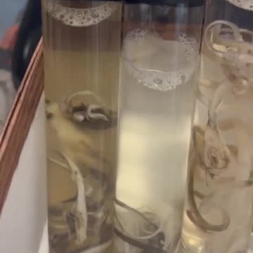 Look at what's coming out of the arteries and veins of deceased Covid vaccine recipients