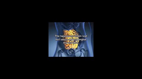 I'll get em this time