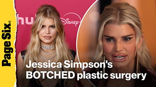 See Jessica Simpson's jaw-dropping BOTCHED plastic surgery face for her 'All's Fair' acting role