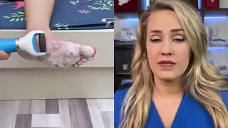 Breaking: Doctor reacts to callus shaving device