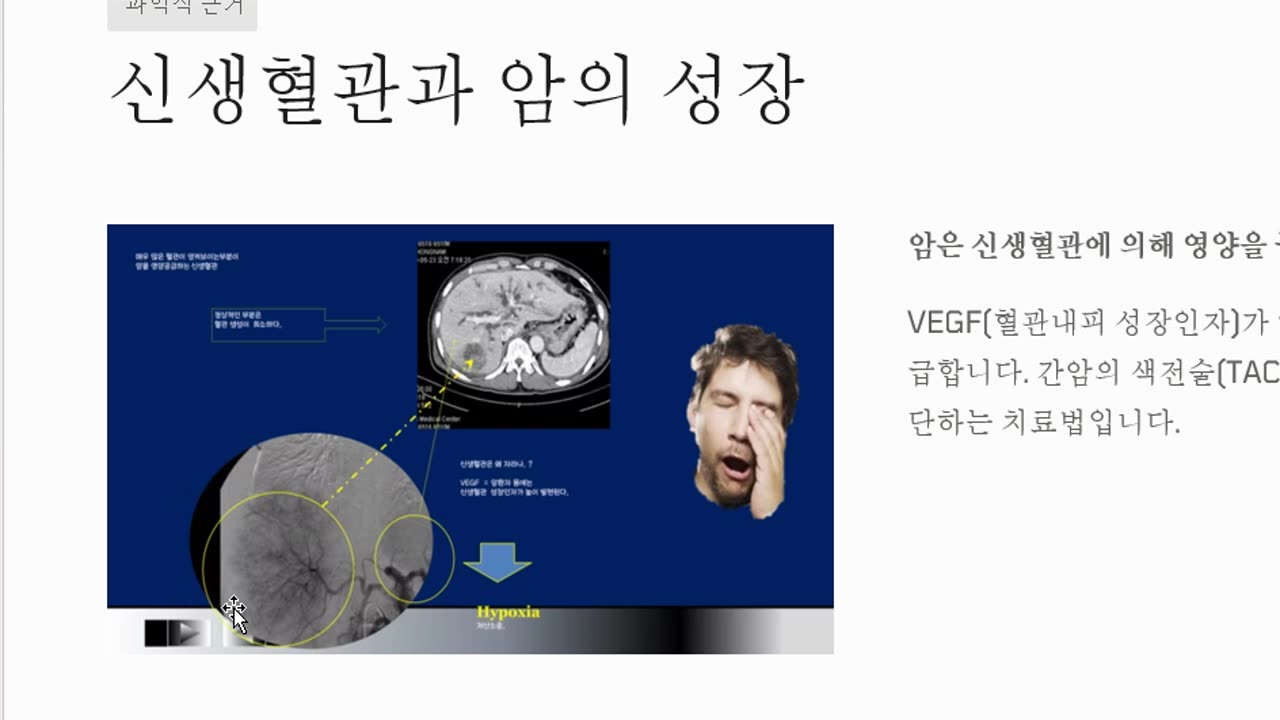 동무이제마 동의수세보원 사상의학으로 보는 태음인, 소음인암치료는 소금섭취와 소변량측정이 중요 반룡인수한의원 한태영원장님