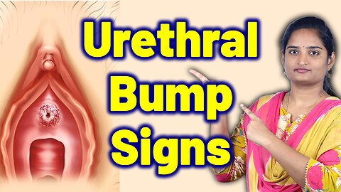 Signs & Symptoms Of Urethral Caruncle, Urinary Opening Growth, Urethral Bump | Homeopathy Cure