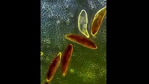 LUGOL'S IODINE & PARASITES UNDER THE MICROSCOPE BRIEF 👊