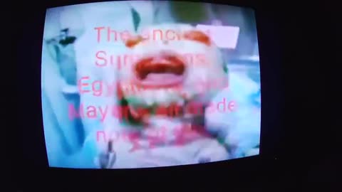 'Alien' Reptilian Human Hybrid! They Call it 'Harlequin Ichthyosis'! [24.02.2024]