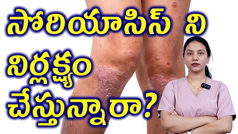 సోరియాసిస్ నిర్లక్ష్యం చేస్తున్నారా ? Neglet Complications of Psoriasis Homeopathy Treatment Cure
