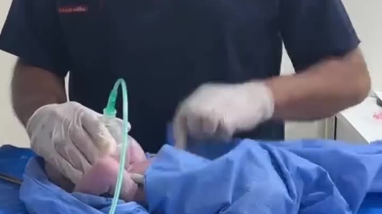 Doctor Saving the Newborn's Life
