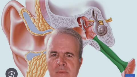 Why do I have tinnitus, ear pressure, vertigo , and TMD? | Craniocervical care | Neckwise