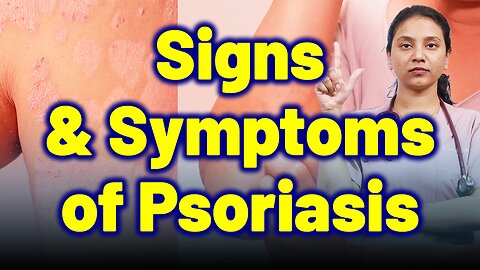 Signs & Symptoms of Psoriasis | Treatment Cure Relief Medicine | Skin Hair Nail | Homeopathy