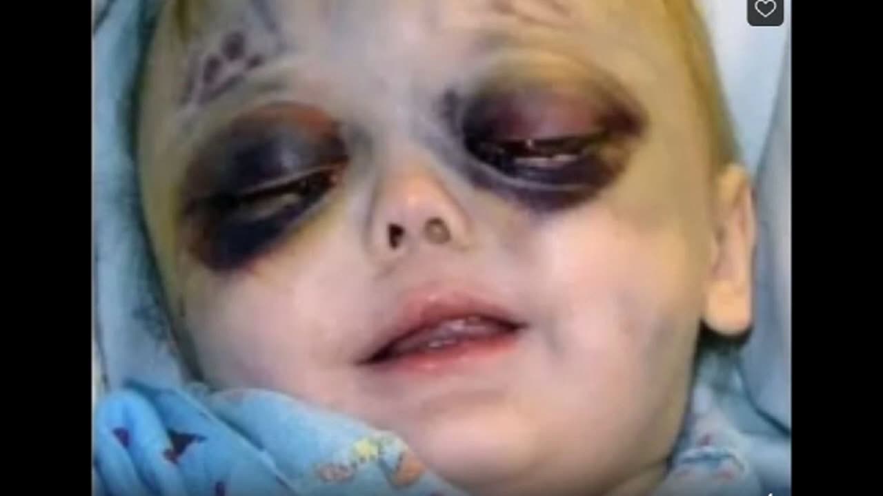 PÉDOSATANISME Adrenochrome attention images très choquantes