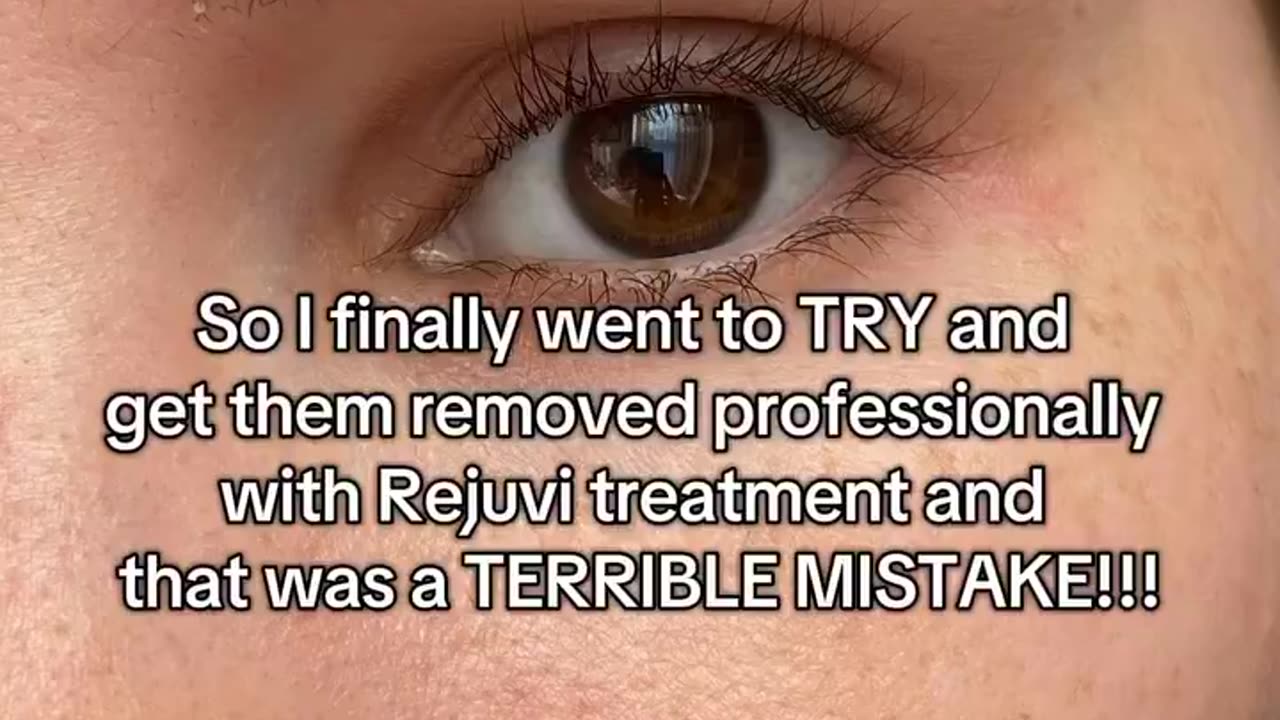 Maybe don't get your eyebrows 'microbladed.' 😮