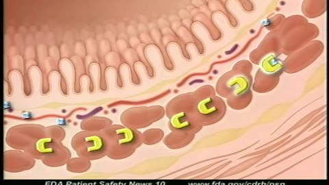 FDA Patient Safety News (Novemb... - FDA Patient Safety News (November 2002) - gov.ntis.ava21162vnb1