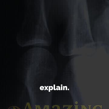 Scientific Accidents — Entry #2: X‑Rays