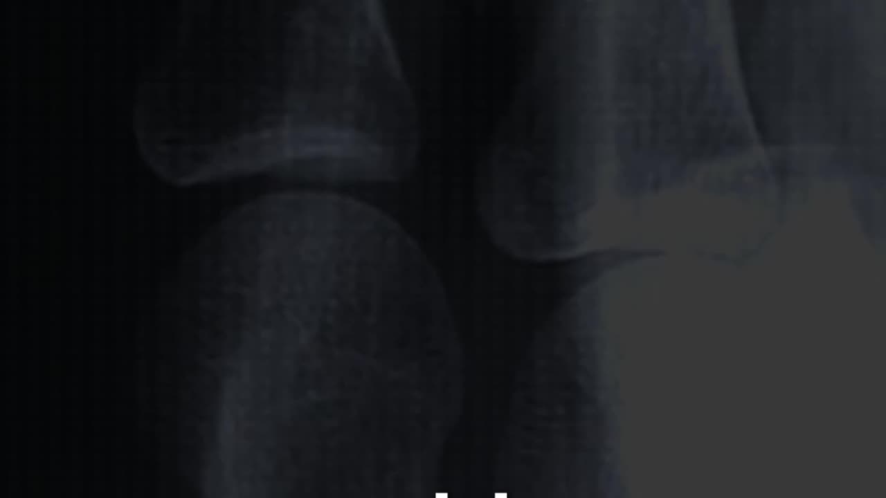Scientific Accidents — Entry #2: X‑Rays