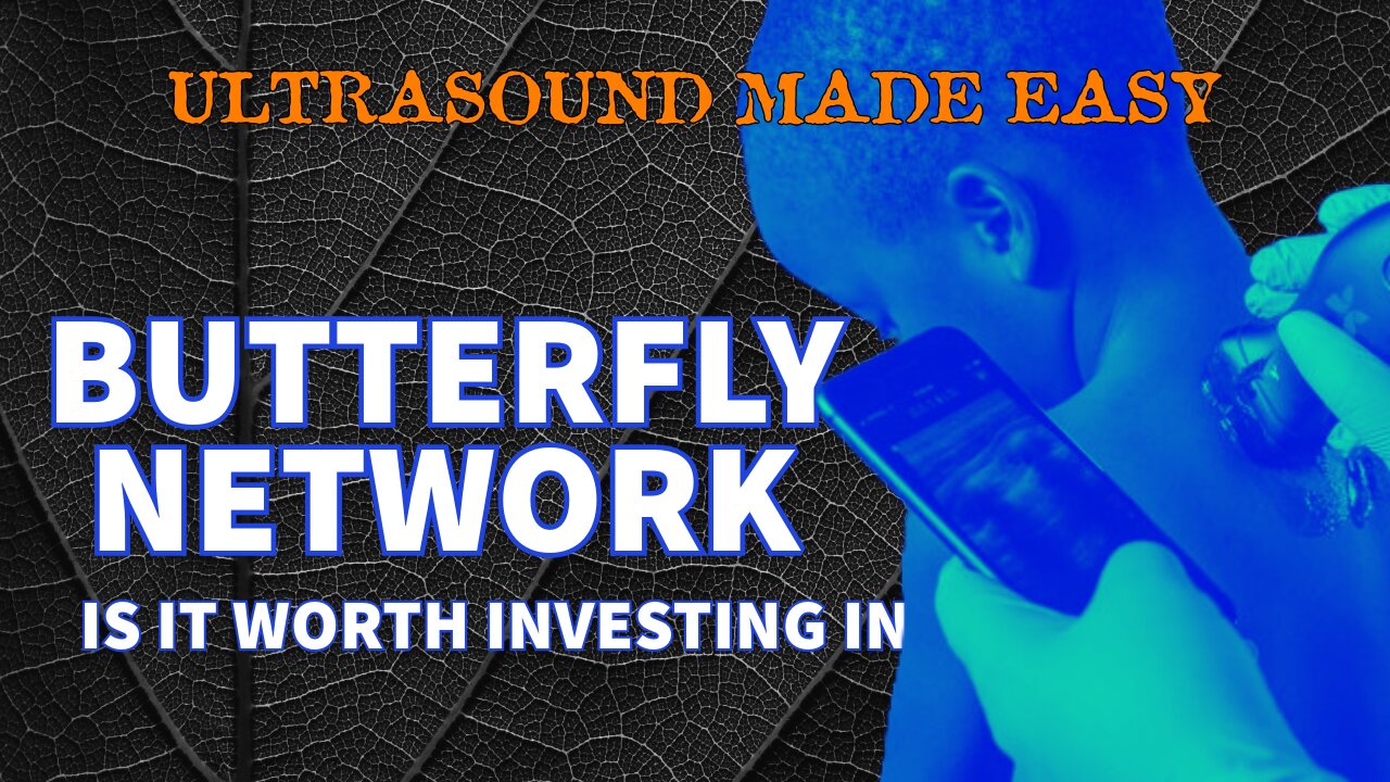 Butterfly Network (NYSE:BFLY) - Is It Worth Investing In? Mobile Ultrasound