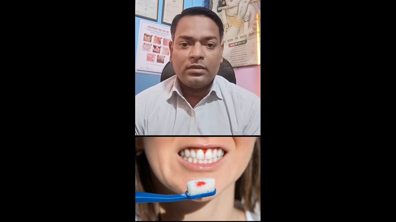 पायरिया का इलाज ।