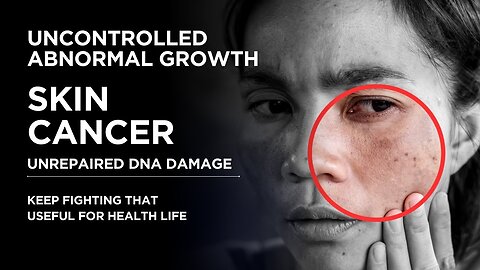 SKIN CANCER! ABNORMAL OF CELL (DNA DAMAGE) DESTROY TISSUE?