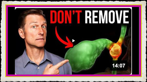 Never Get Your Gallbladder Removed by Dr. Eric Berg
