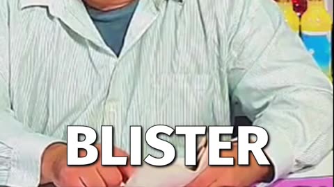 Blister Relief