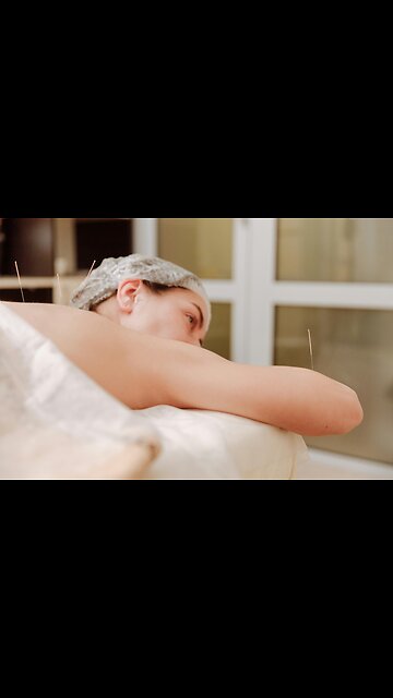 Acupuncture Thornhill: Ancient Healing For Modern Living