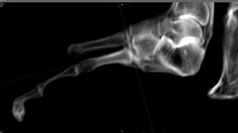 🦶🔍 Maria's Feet Scan Reveals No Manipulation | TheTruthAbove