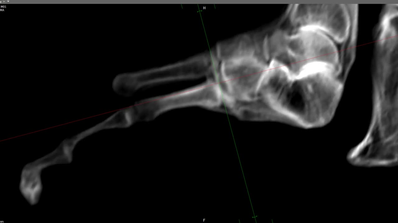 🦶🔍 Maria's Feet Scan Reveals No Manipulation | TheTruthAbove
