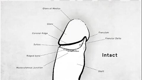 American circumcision Documentary 2017