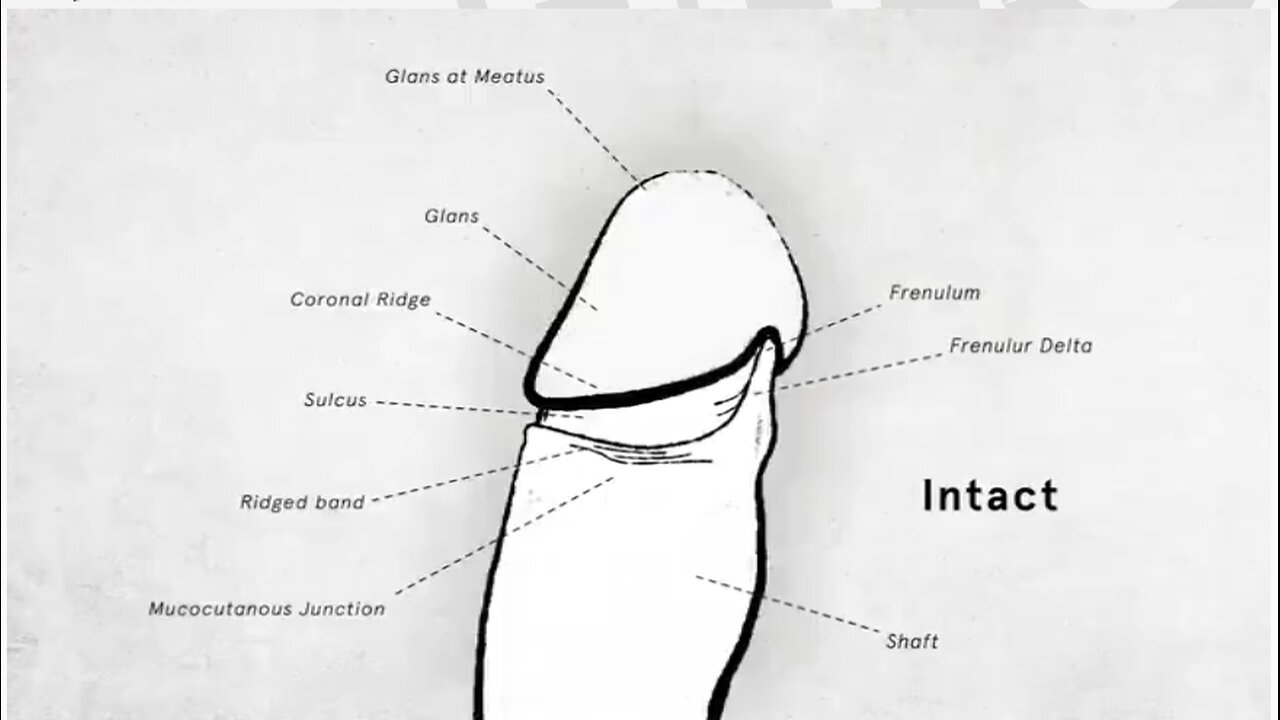 American circumcision Documentary 2017