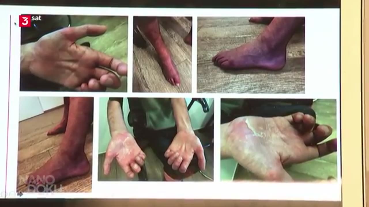 KRANK DURCH IMPFEN-3SAT!!!