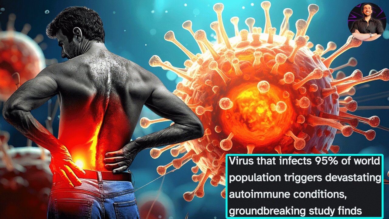 This Virus 95% of People Carry Can TRIGGER a Major Autoimmune Condition