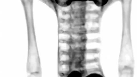 🔍👽 Luisa's DICOM Files Show No Signs of Manipulation! | TheTruthAbove
