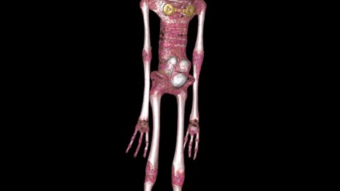 🕵️‍♂️🦴 Luisa's DICOM Files: A Fully Intact Desiccated Corpse! | TheTruthAbove