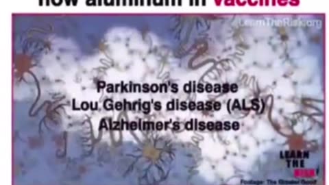 Vaccines - How Aluminium In Vaccines Can Cause Brain Damage