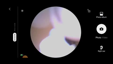 First Time I Saw My Ear And I've Been Living A Lie ( You Might Find It Gross) (December 13, 2024)