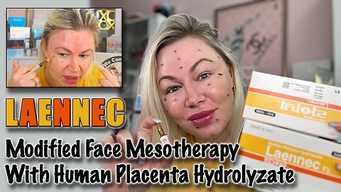 Laennec Modified Face Meso therapy with Human Placenta, AceCosm code Jessica10 saves you money