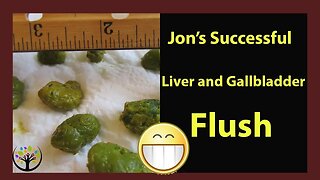 Overcoming Weight Gain After Water Fasting(Jon's Liver Flush Success