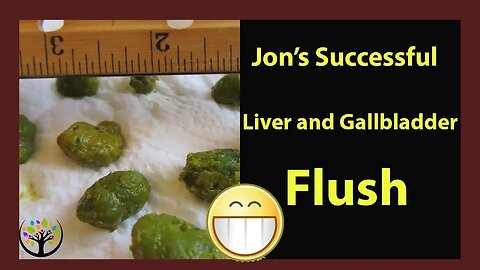 Overcoming Weight Gain After Water Fasting(Jon's Liver Flush Success