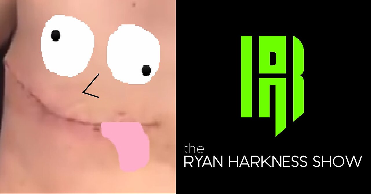 Episode #067: Gay Retard | The Ryan Harkness Show